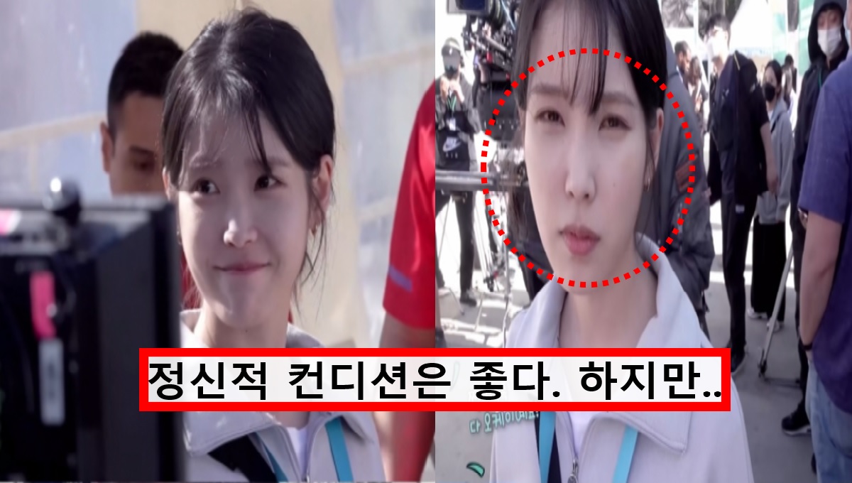 눈이 진짜 너무 아프다 각막 손상 언급한 아이유 심각한 눈상태에 팬들 모두 걱정했다