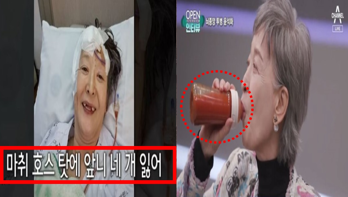 "앞니 네 개 잃고 젖병 음식 섭취".. 배우 윤석화 안타까운 근황 공개에 학력 위조 논란 재조명됐다