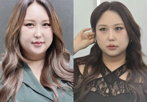5차 코 성형 고백, 갈비뼈까지 소진