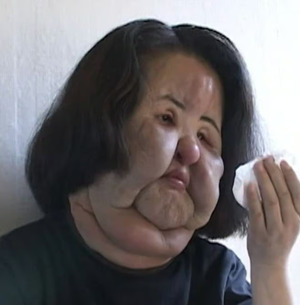 '선풍기 아줌마' 한혜경 7주기, 불법 성형 비극 재조명